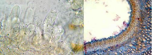 Foto microscopio de basidios y cistidios en láminas                         Foto microscopio de basidios en poros